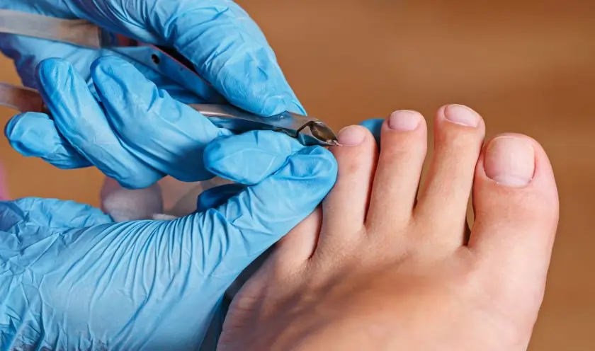 Chiropody
